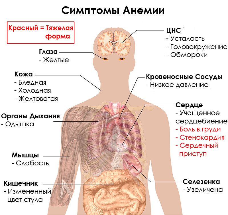 Заболевания сопровождающиеся анемией. Заболевания крови симптомы.